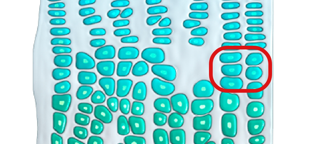 Image of cartilage growth plate without achondroplasia