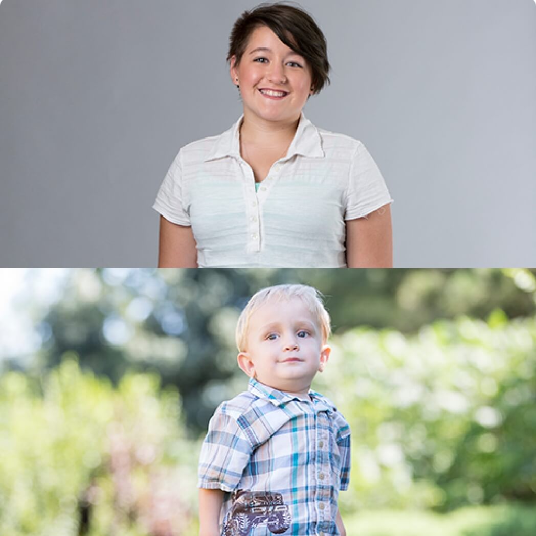 Image of two non classical patients