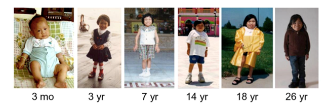 Variable_disease_progression