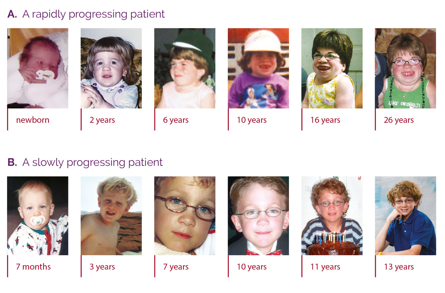 Photographs showing the rate of progression