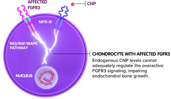 chondrocyte-affected-fgfr3