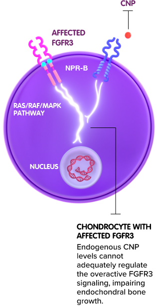 chondrocyte-affected-fgfr3