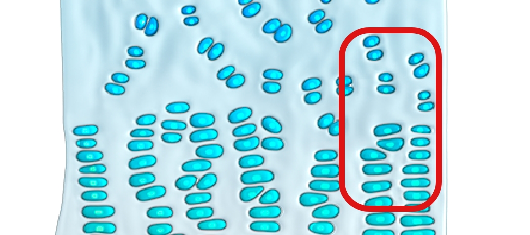 Image of cartilage growth plate without achondroplasia